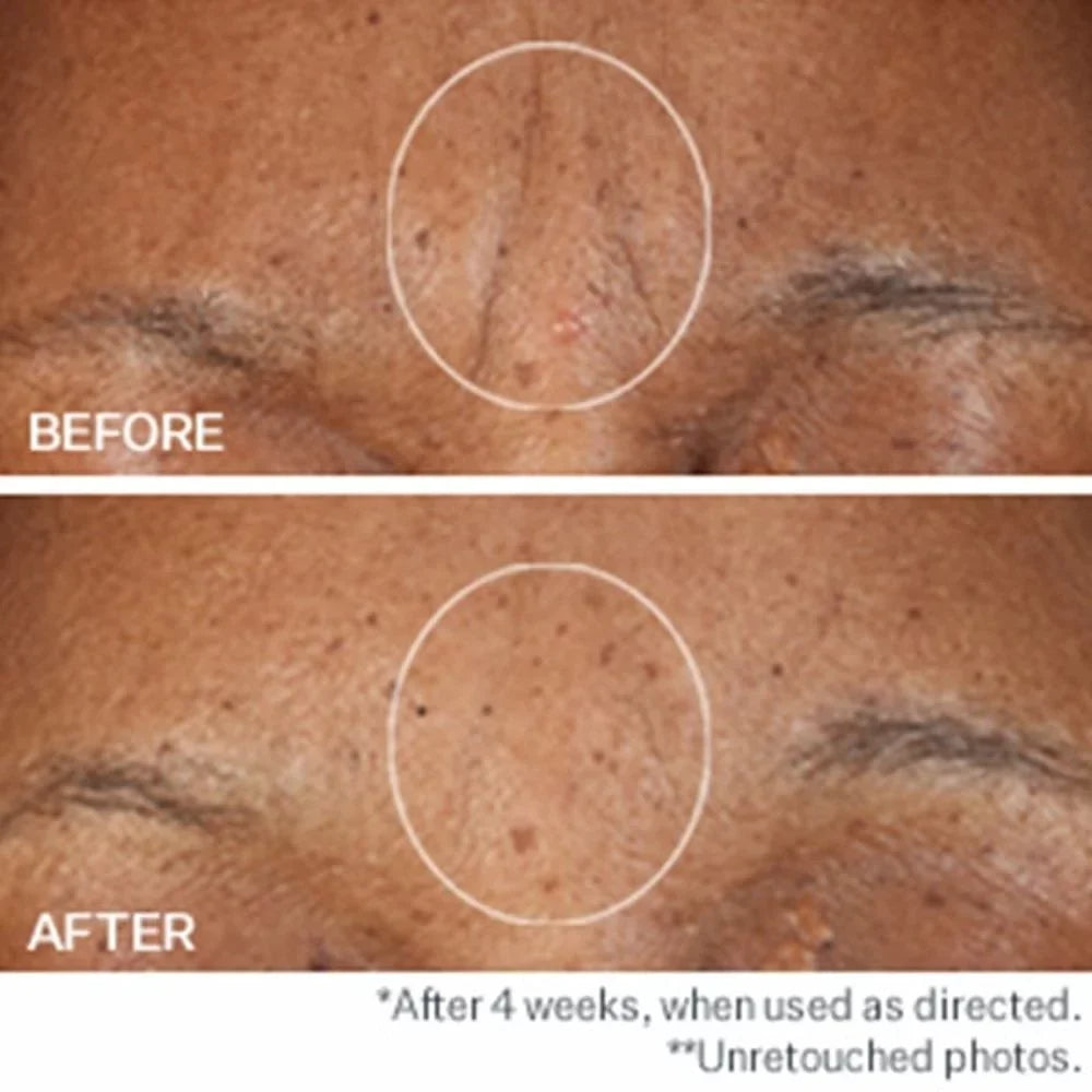 SD 1.6 2-pack Advanced oz, Concentrate, Intensive PLUS StriVectin Moisturizing